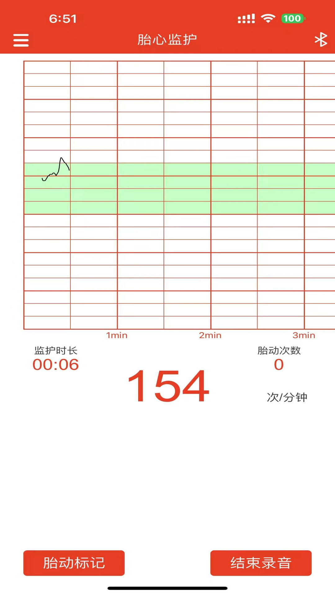 左点胎心仪app下载免费_左点胎心仪平台appv1.7